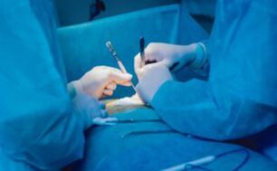 Ligamentotomija - operacija za povećanje duljine penisa